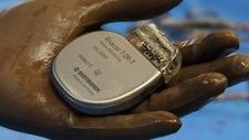 CHUCB utiliza cardioversores desfibrilhadores implantáveis