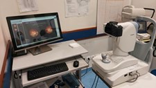 CHULN com diagnóstico do glaucoma através de inteligência artificial