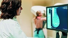 IA pode ajudar radiologistas no rastreio do cancro de mama