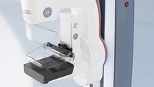 Imagiologia do HVFX tem novo mamógrafo com tecnologia 3D