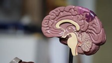 Investigação: Paramiloidose estende-se de forma precoce ao cérebro