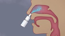 Spray nasal pode travar reprodução da COVID-19