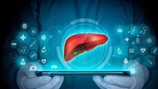 Investigadores desenvolvem ferramenta de IA para avaliar tratamento de cancro do fígado