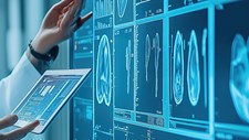 Iniciativa com sensores inteligentes visa transformar os cuidados de saúde